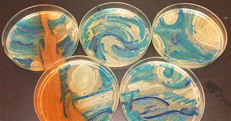 Microbiologists Create ‘Starry Night’ And Other Art With Bacteria For ...