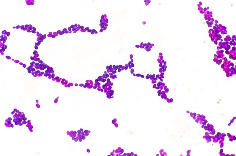 Colonia de candida bajo visión microscópica o infección por hongos ...