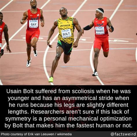 Pin by Camille on WTF Facts!! | Scoliosis, Usain bolt scoliosis, Weird facts