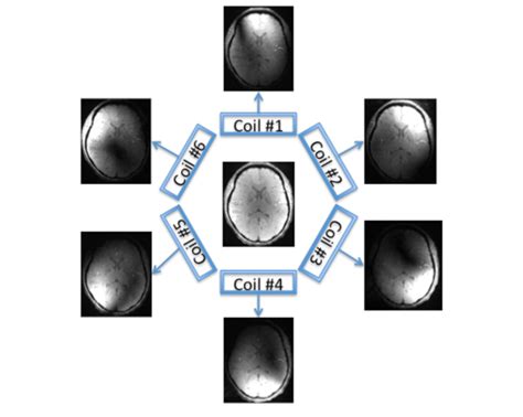 Example head coil arrangement showing coil specific sensitivity ...