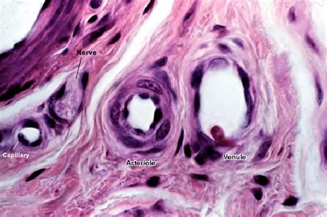 shows a histological image of different vessel types. See Figure 2 for... | Download Scientific ...