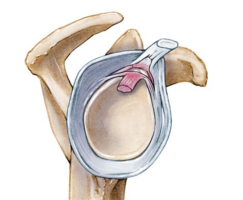 Labral tear - SLAP lesion