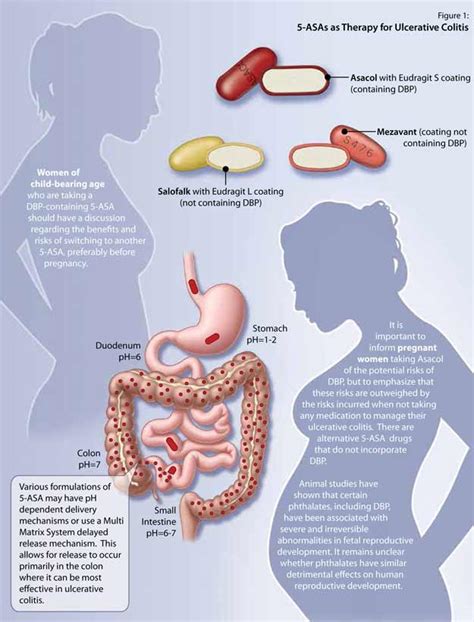 Phthalates in 5-Aminosalicylates: Informing Therapeutic Choice and ...