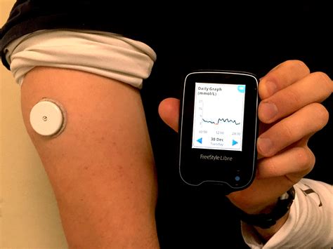 Abbott’s FreeStyle Libre – Transforming Glucose Monitoring Through ...