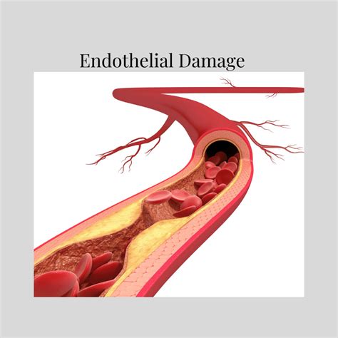 Endothelial Damage – Why You Should Be Concerned – Especially Now! | Raleigh Natural Wellness