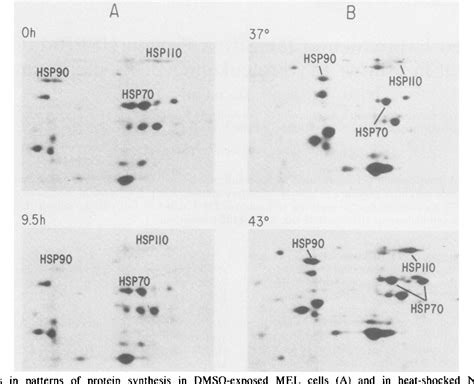 Figure 1 from Decreased expression of the stress protein HSP70 is an early event in murine ...