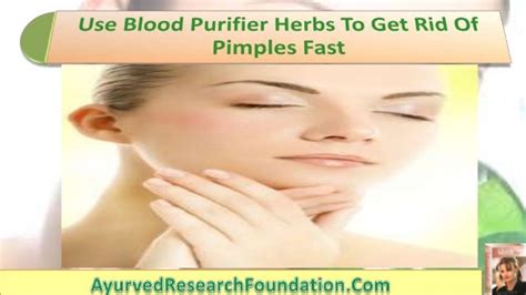 Use Blood Purifier Herbs To Get Rid Of Pimples Fast