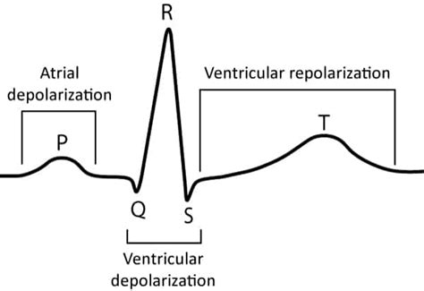 Figure 7. The classical ECG curve – ECG learning