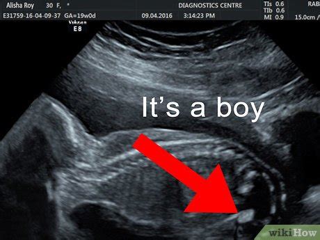 How to Read an Ultrasound Picture: 9 Steps (with Pictures)