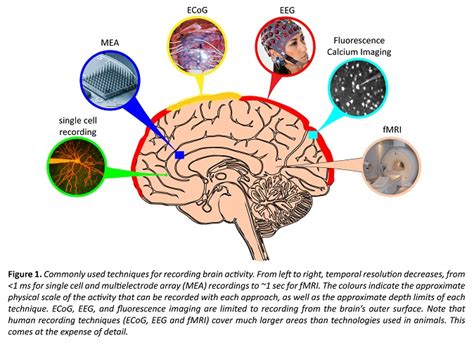 How to measure brain activity in people - Queensland Brain Institute - University of Queensland