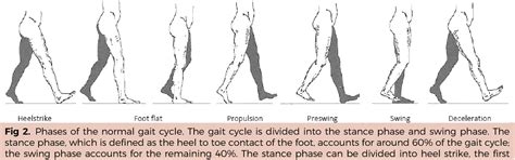 Figure 2 from Prolonged stance phase during walking in intermittent claudication. - Semantic Scholar