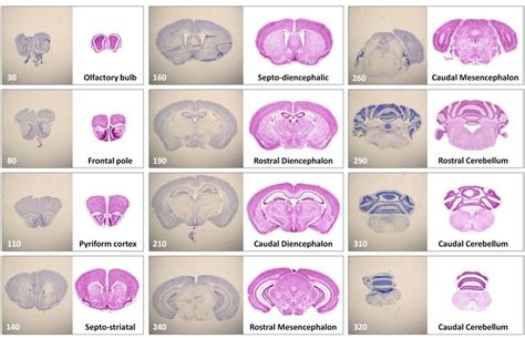 2 Representative mouse brain reference chart. For each cryo-preserved... | Download Scientific ...