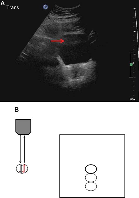 [PDF] Artifacts in diagnostic ultrasound | Semantic Scholar