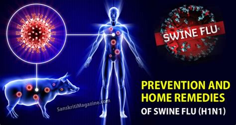 Prevention and home remedies of Swine Flu (H1N1)
