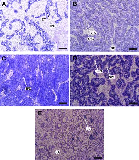 Histology of gonad development stages of males of Crassostrea gigas ...