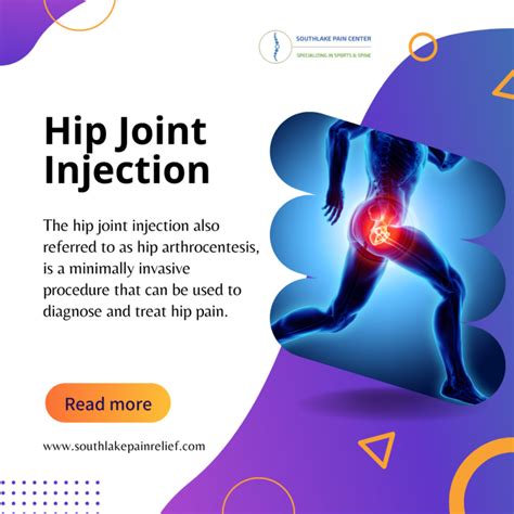 Hip Joint Injection – Preparation, Procedure, and Treatment in ...