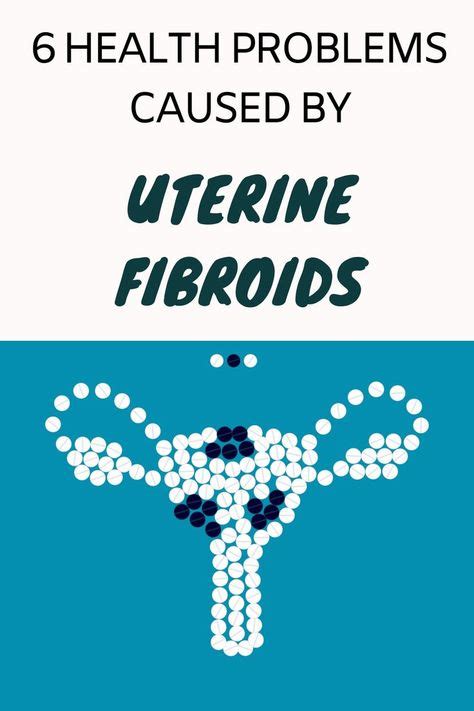 uterine fibroids Life Hacks, Fibroid Symptoms, Fibroid Tumors, Fibroid ...