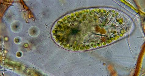 Protozoa protists unicellular organism under microscope Euglena, Paramecium and amoebas 800x ...