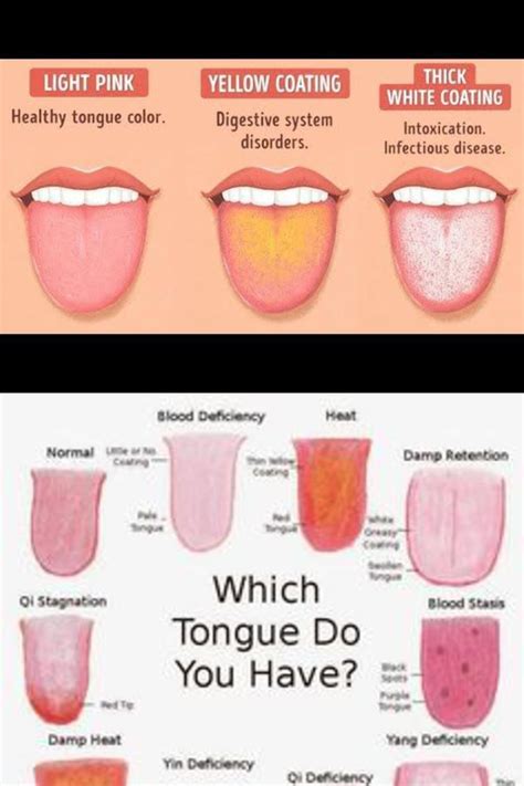 Healthy Tongue Color