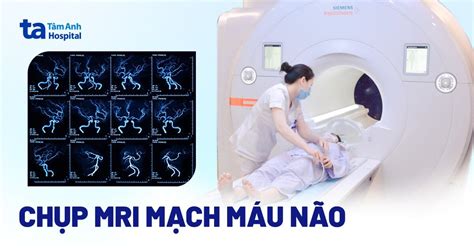 Chụp MRI mạch máu não (MRA): Ưu điểm, chỉ định và quy trình thực hiện