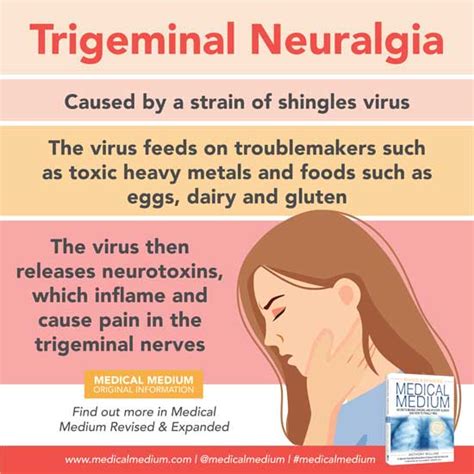 Trigeminal Neuralgia