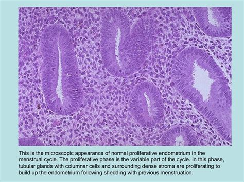 Pathology of cervix