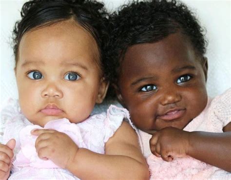 Incredible: These 8 Strange Facts About Twins Will Make Your Jaw Drop