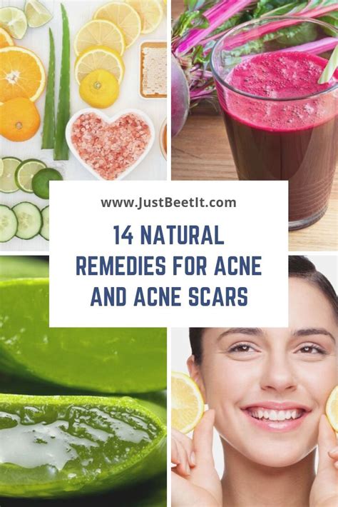 14 Easy and Natural Remedies to Remove Acne and Acne Scars — Just Beet It