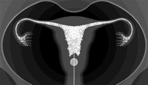 Hysterosalpingogram - Encino, CA - Bakersfield, CA - Los Angeles, CA ...