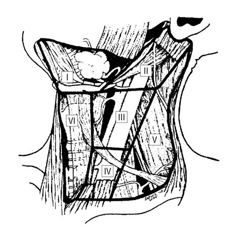 Neck Dissection Classification Update: Revisions Proposed by the American Head and Neck Society ...