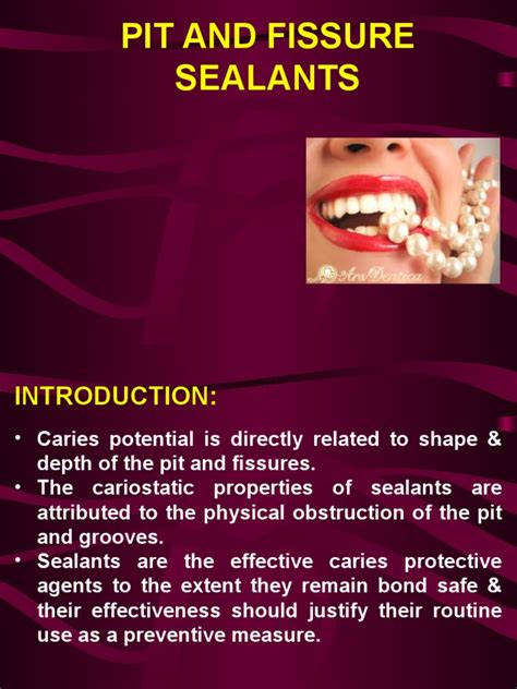 Pit and Fissure Sealants | PDF | Dentistry | Mouth