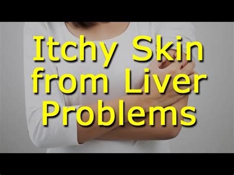 Liver Disease Itchy Skin Rash