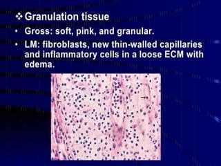 Granulation tissue formation | PPT