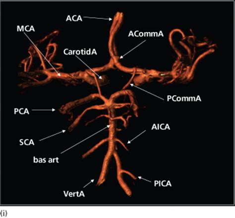 Brain | Radiology Key