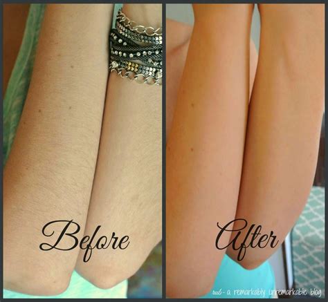 Arm Hair Removal for Women | Edmund Designs