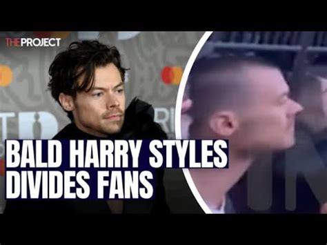 Photos Of Bald Harry Styles Divide Fans - YouTube