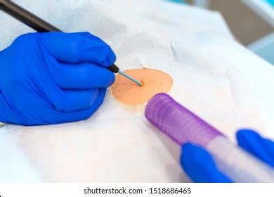 2,909 Skin Biopsy Images, Stock Photos & Vectors | Shutterstock