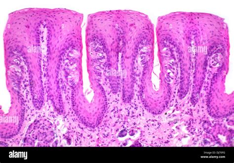 Papillae taste buds, human tongue, bright field photomicrograph Stock Photo: 62849012 - Alamy