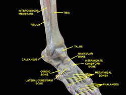 Syndesmosis Tibia Fibula