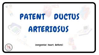 PATENT DUCTUS ARTERIOSUS | Causes | Symptoms | Pathophy... | Doovi