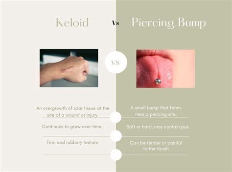 Piercing Bumps Vs. Keloids: What Is The Difference?