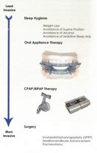 Obstructive Sleep Apnea – North Heaven Family Dentistry