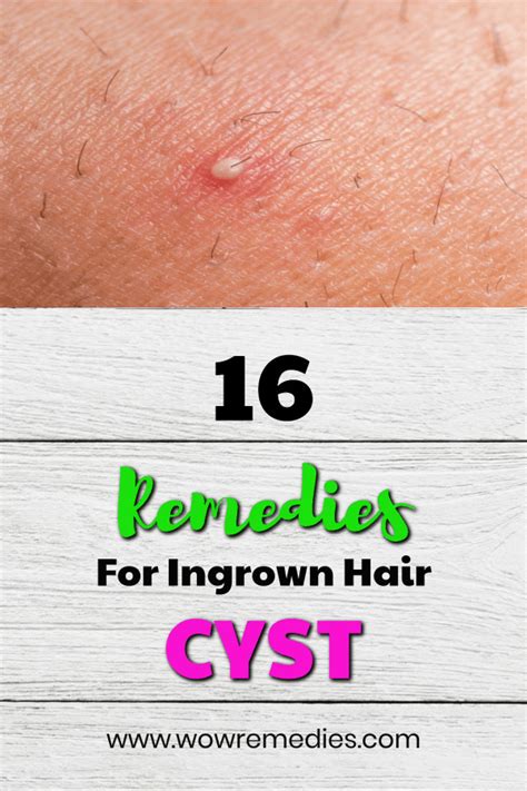 Ingrown Hair Cyst Armpit