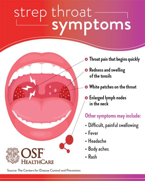 What to know about strep throat | OSF HealthCare