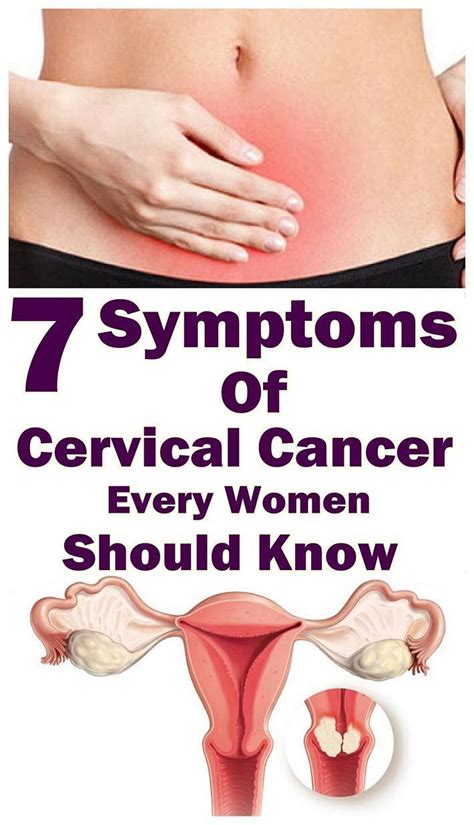 7 warning symptoms of cervical cancer that every women should know ...