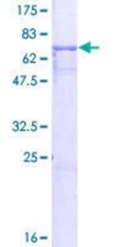 Novus Biologicals™ Recombinant Human A33/GPA33 GST (N-Term) Protein 10 μg | Fisher Scientific