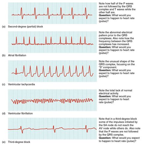 Cardiac Muscle and Electrical Activity | Nursing mnemonics, Icu nursing, Nurse