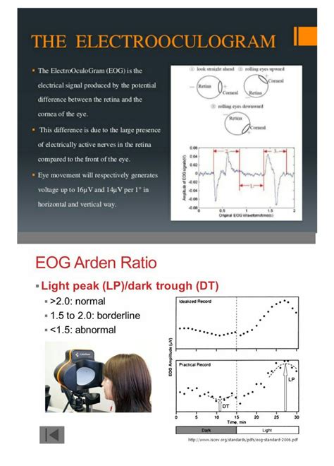 Electrooculogram(EOG) & Arden ratio... | The retina, Eye roll, Ent