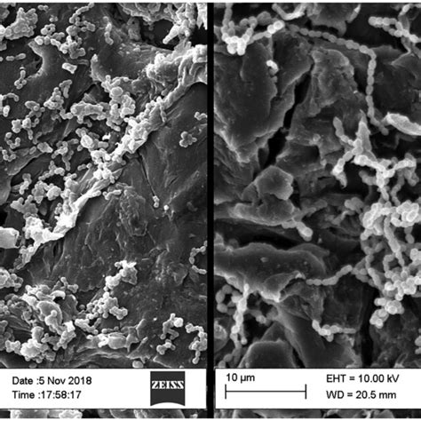 Streptococcus oralis (left) and Streptococcus gordonii (right) biofilm ...