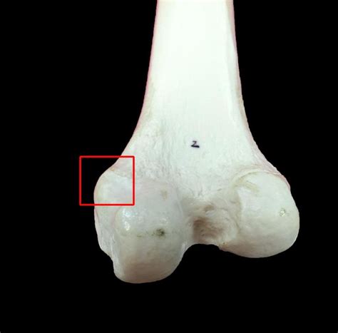 adductor tubercle - Google Search | Dome